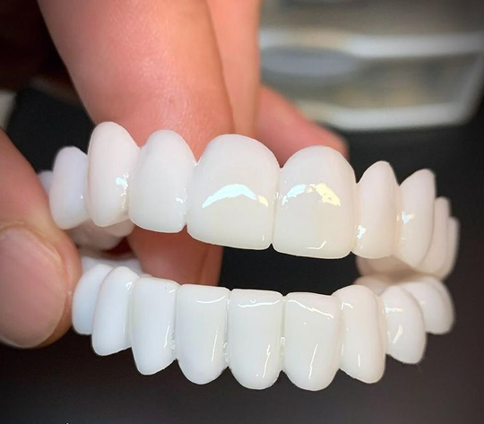 DentAlign Dental Prosthetics for Missing Teeth & Smile Restoration