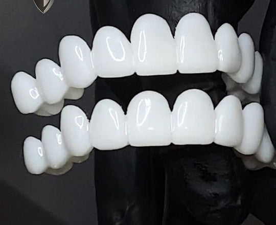 DentAlign Dental Prosthetics for Missing Teeth & Smile Restoration